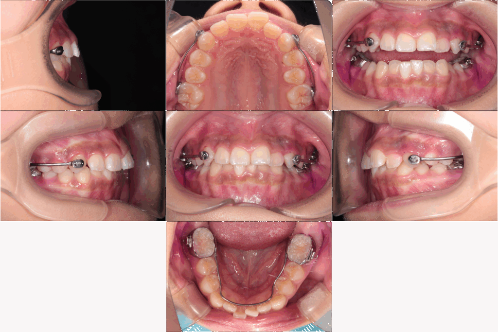 - 福山市の総合歯科 河底歯科・矯正歯科Blog