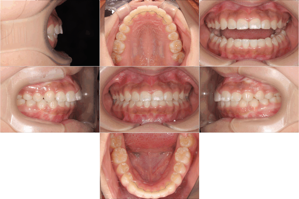 - 福山市の総合歯科 河底歯科・矯正歯科Blog