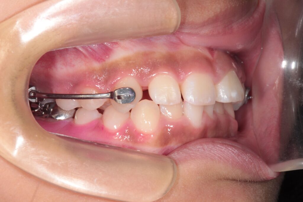 - 福山市の総合歯科 河底歯科・矯正歯科Blog