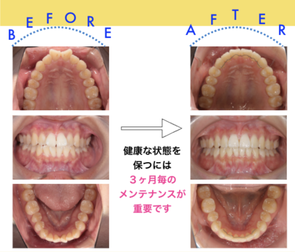 - 福山市の総合歯科 河底歯科・矯正歯科Blog