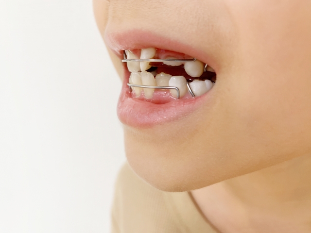 - 福山市の総合歯科 河底歯科・矯正歯科Blog