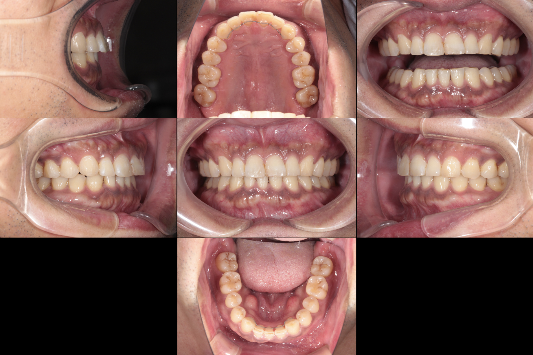 - 福山市の総合歯科 河底歯科・矯正歯科Blog