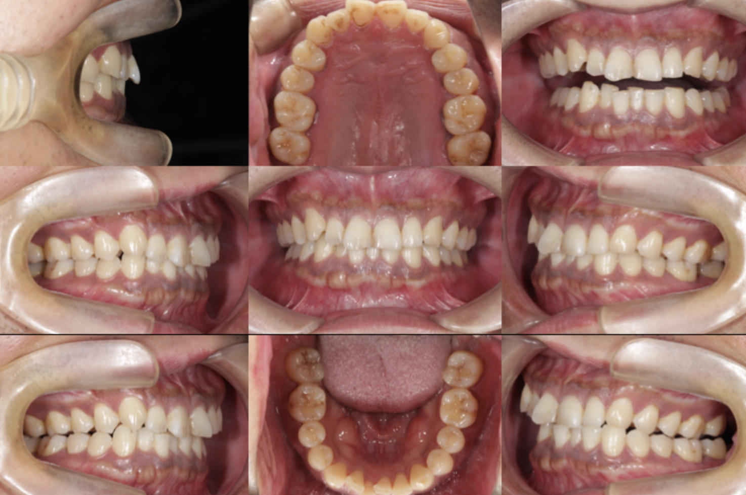 - 福山市の総合歯科 河底歯科・矯正歯科Blog