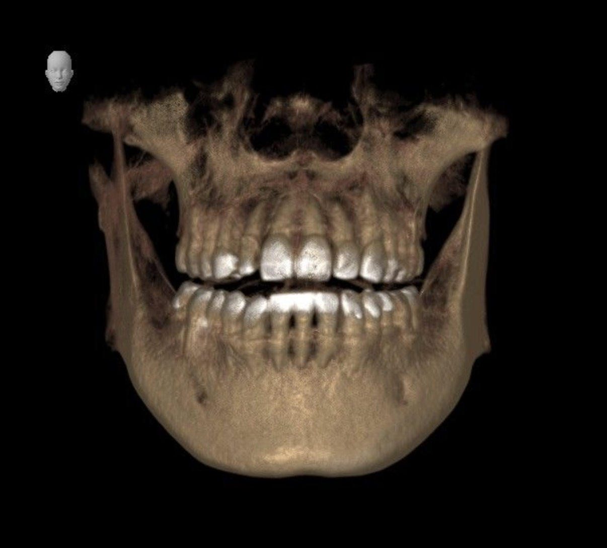 - 福山市の総合歯科 河底歯科・矯正歯科Blog