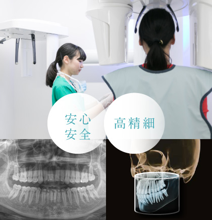セファロ付き歯科用3D（立体）CT