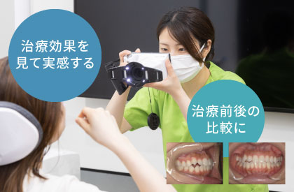 歯科口腔内撮影用デジタルカメラ