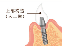 上部構造