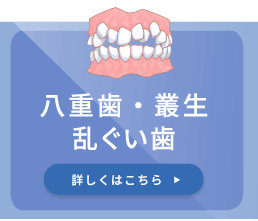 八重歯・叢生乱ぐい歯
