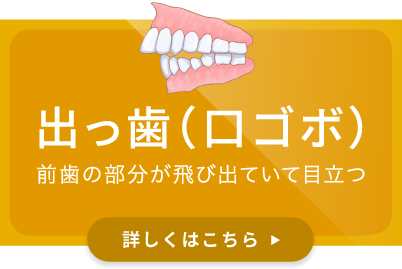 出っ歯（口ゴボ）／前歯の部分が飛び出ていて目立つ