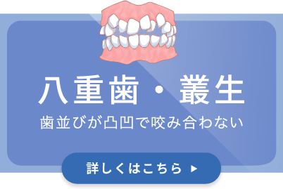 八重歯・叢生／歯並びが凸凹で咬み合わない