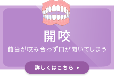 開咬／前歯が咬み合わず口が開いてしまう
