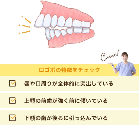 唇や口周りが全体的に突出している・上顎の前歯が強く前に傾いている・下顎の歯が後ろに引っ込んでいる
