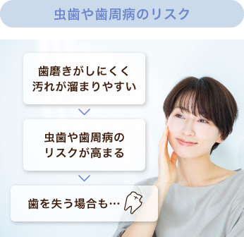 歯磨きがしにくく汚れが溜まりやすい・虫歯や歯周病のリスクが高まる・歯を失う場合も…