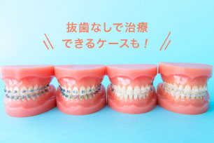 抜歯なしで治療できるケースも！