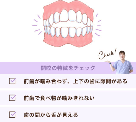 前歯が噛み合わず、上下の歯に隙間がある・前歯で食べ物が噛みきれない・歯の間から舌が見える