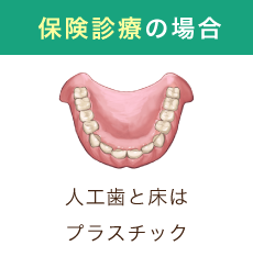 保険診療の場合 人口歯と床はプラスチック