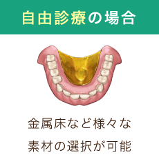 自由診療の場合 金属床など様々な素材の選択が可能