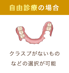 自由診療の場合 クラスプがないものなどの選択が可能