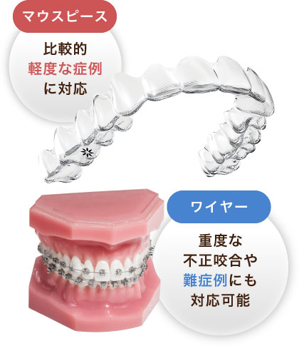マウスピース：比較的軽度な症例に対応／ワイヤー：重度な不正咬合や難症例にも対応可能