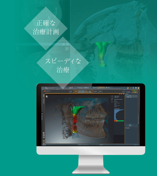 正確な治療計画 スピーディな治療